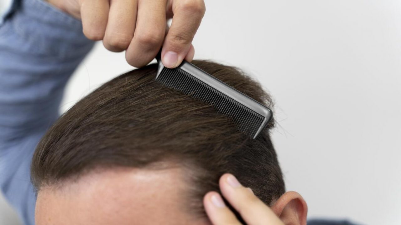 Caída de pelo: tratamientos para frenar su caída en otoño