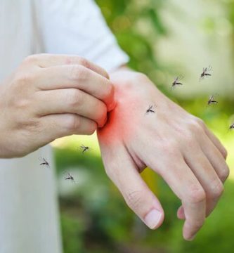 Claves para evitar (o tratar) las molestas picaduras de mosquitos